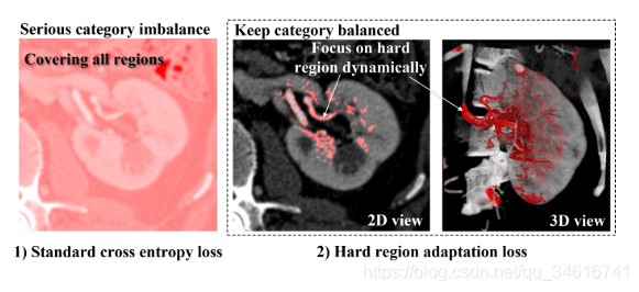 Dense biased networks with deep priori anatomy and hard region adaptation: Semi-supervised learning