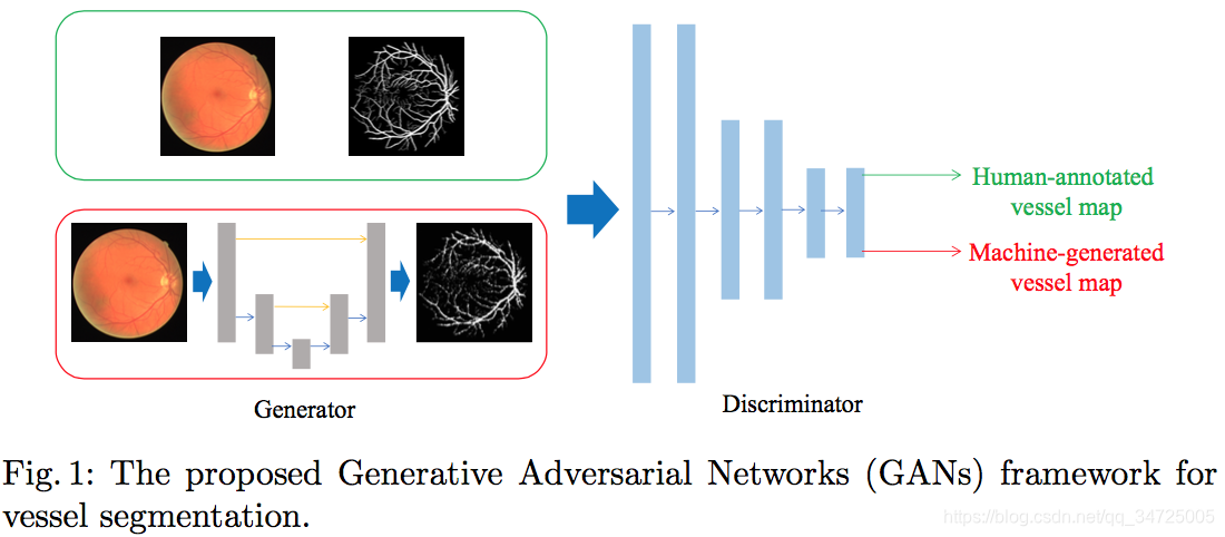 Retinal Vessel Segmentation in Fundoscopic Images with Genetative Adversarial Networks